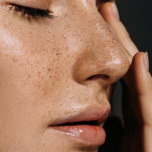 Hydrate, Protect, Glow: The Secret to a Resilient Skin Barrier
